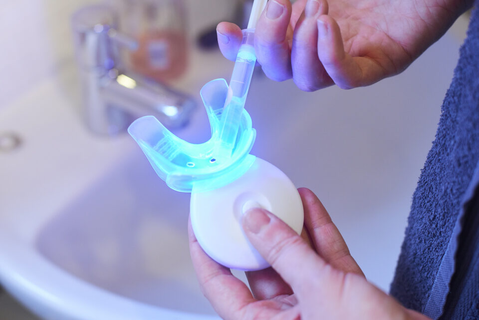 Teeth whitening at Modern Touch Dental Glendale in Glendale, WI, using KöR Whitening System.