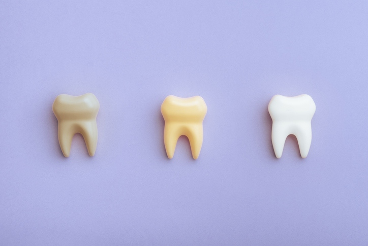 teeth stains